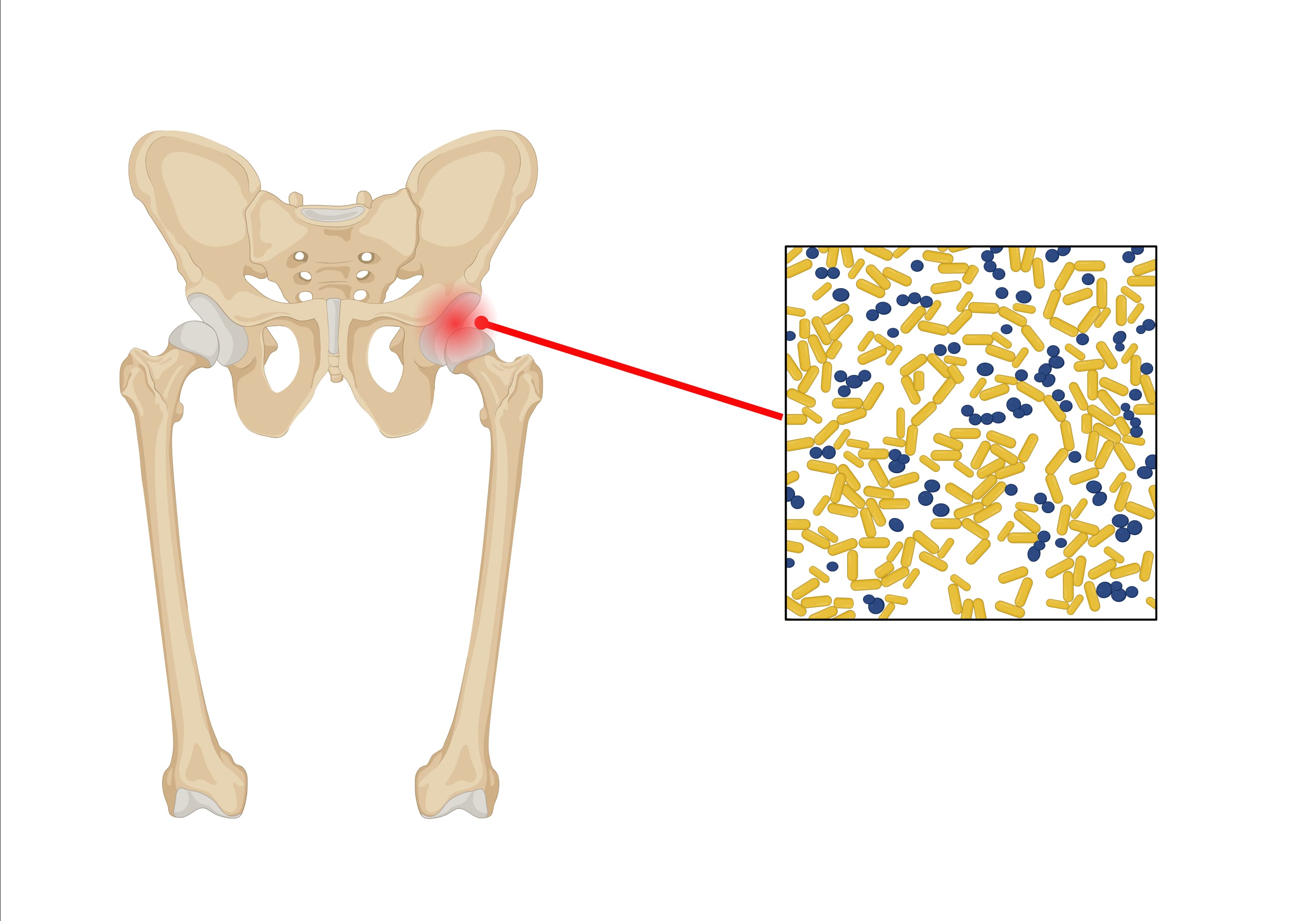 髋关节第一张 image